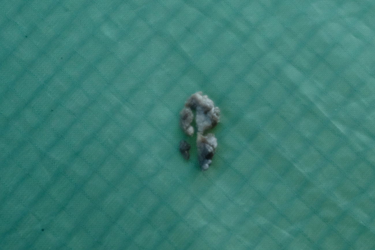 Vogelkacke